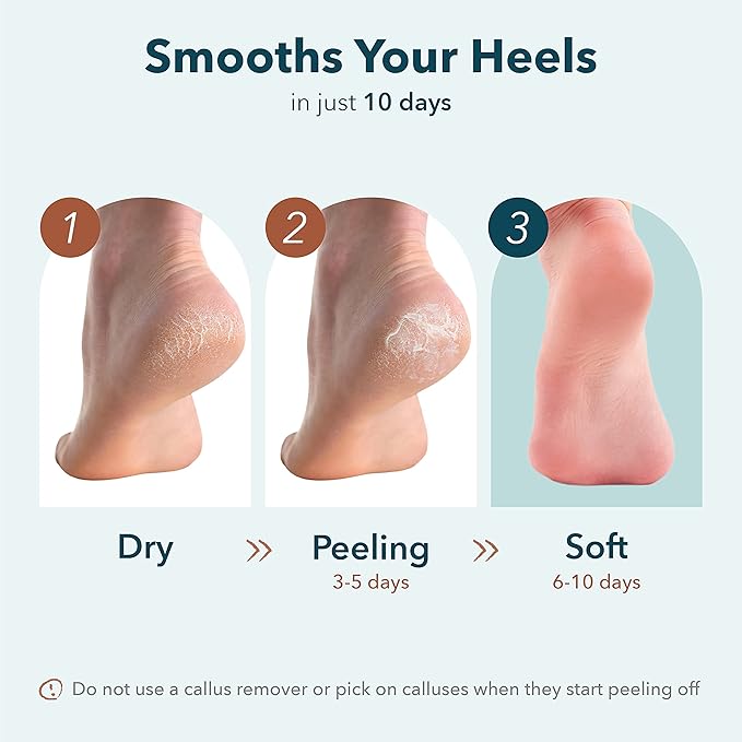 Purederm Exfoliating Heel Mask (1 Pair) – Heel Peeling Masks Gently Remove calluses from Your Heel