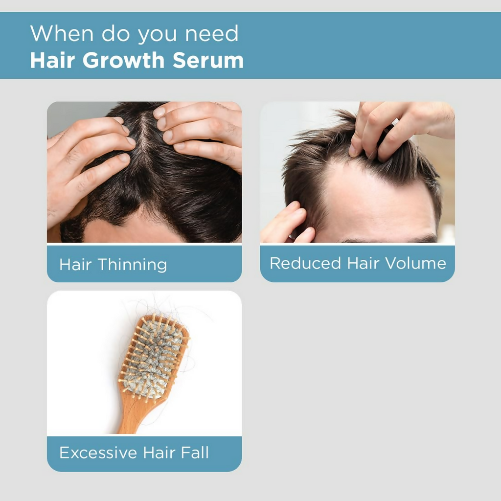 The Man Company Hair Growth Serum For Man