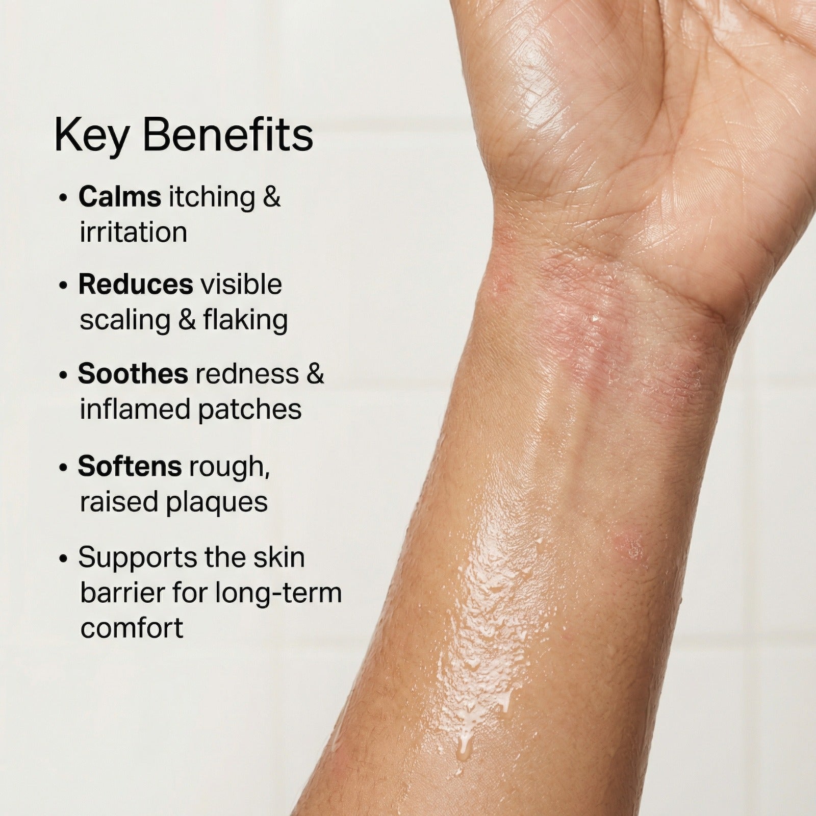 Vedicderm Psoriasis Oil 2-in-1 Skin + Scalp Relief Oil