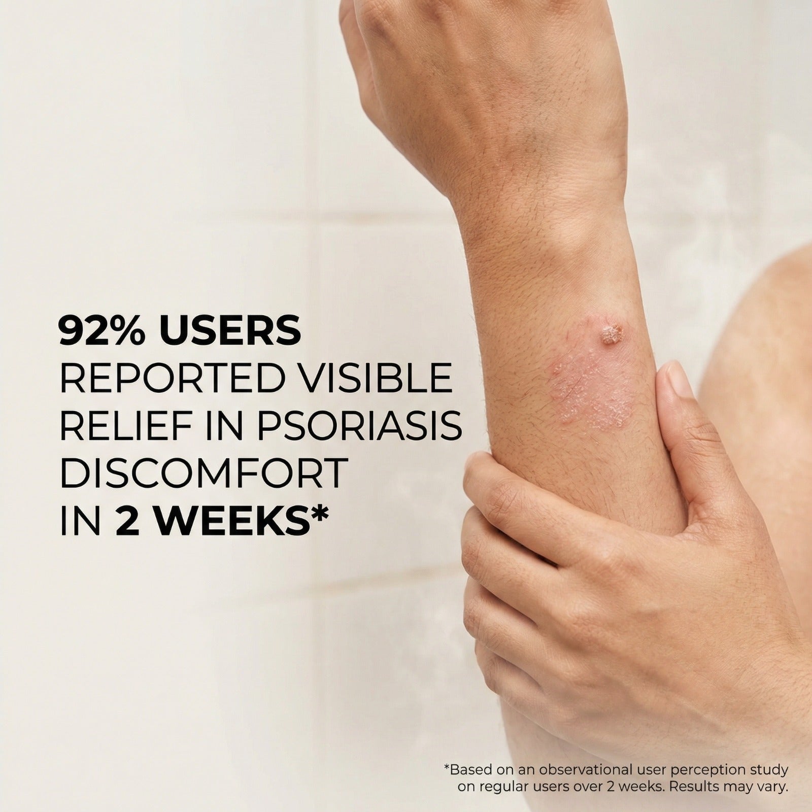 Vedicderm Psoriasis Cream