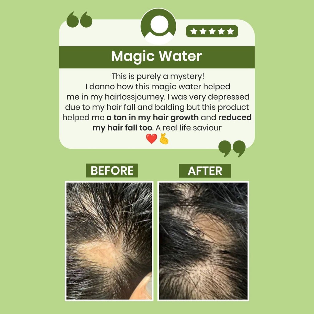Alps Goodness Rosemary Water for Hair Regrowth