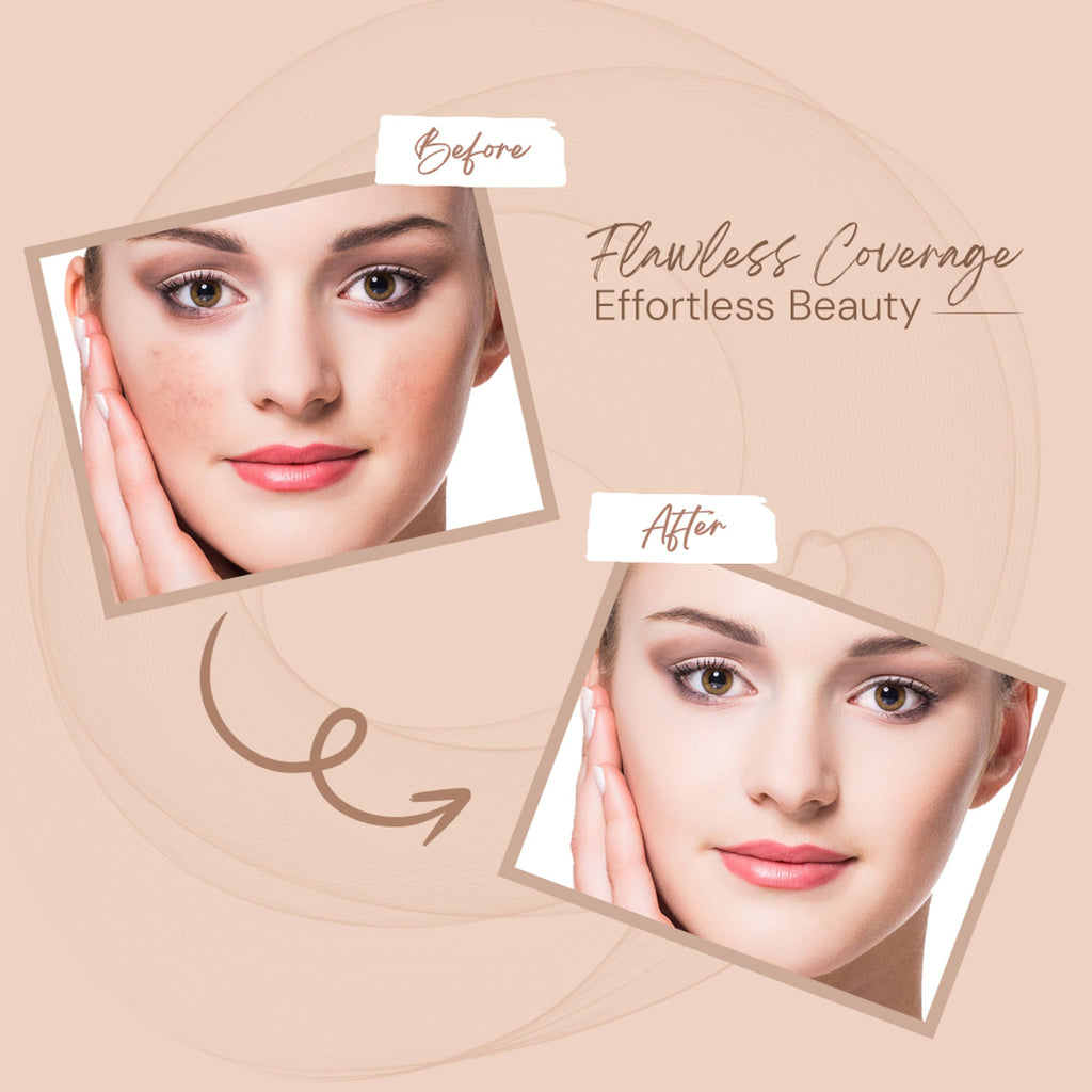 Shryoan Full Coverage and Lightweight Formula Spot on Concealer - 5