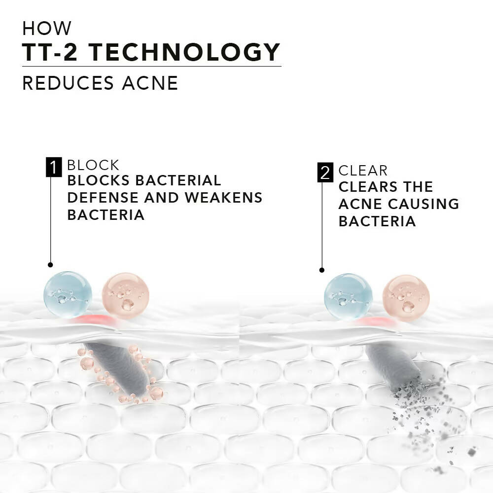 Novology Acne Spot Corrector Gel With 0.1% Thymol + Terpineol