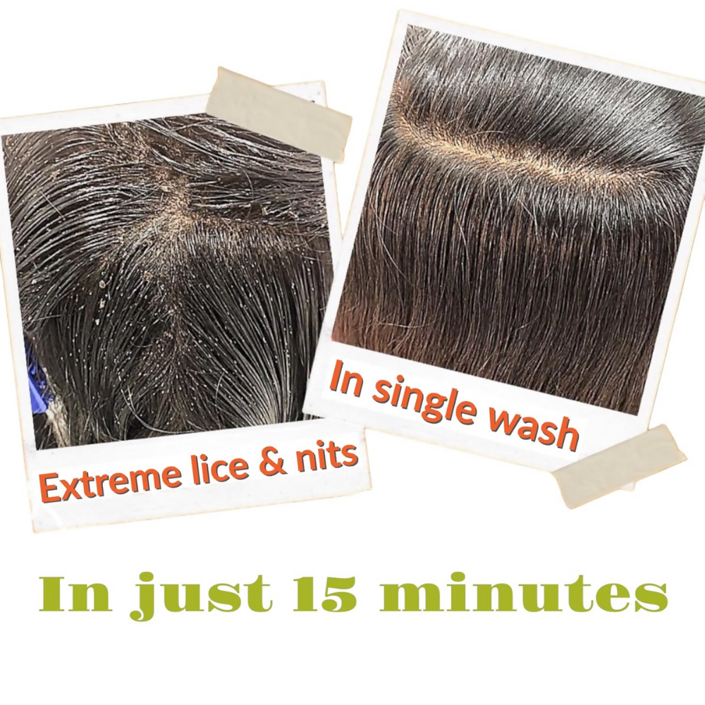 Botanical Luxuriate Tea Tree Anti Lice and Nits Shampoo & Comb